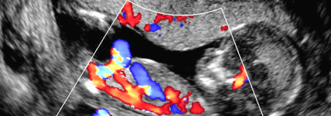 A importÃ¢ncia da ultrassonografia morfolÃ³gica fetal no1Âº trimestre .